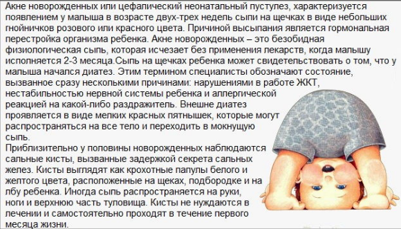 Гормональная сыпь у грудничка когда проходит 16