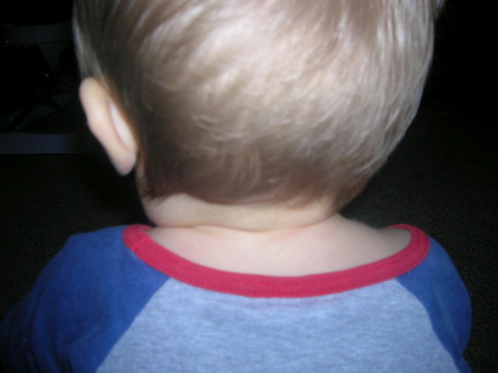 Температура и лимфоузлы на шее у ребенка. Воспаленные затылочные лимфоузлы. Увеличенные затылочные лимфоузлы. Воспаление на затылке у ребенка. Затылочный лимфоузел воспален у детей.