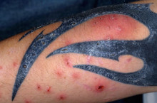 Вред татуировок для кожи человека