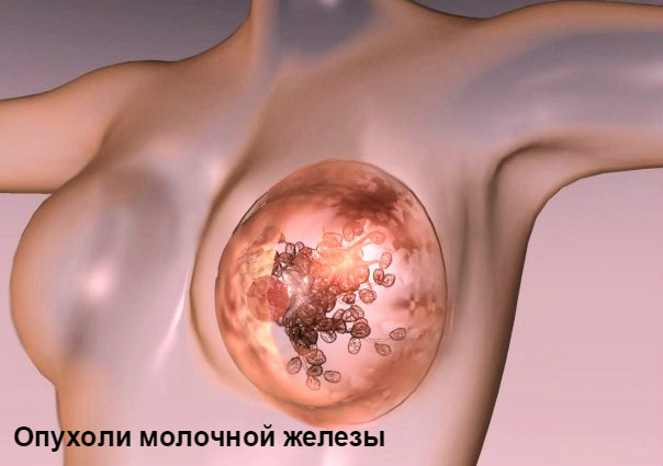 Сыпь при мастопатии на молочной железе thumbnail